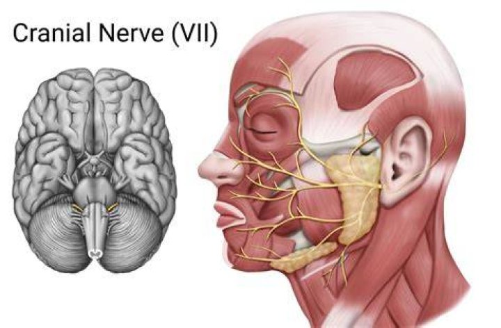 How do you fix the 7th cranial nerve