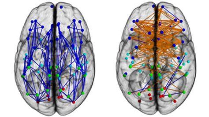 How mens brains are wired differently