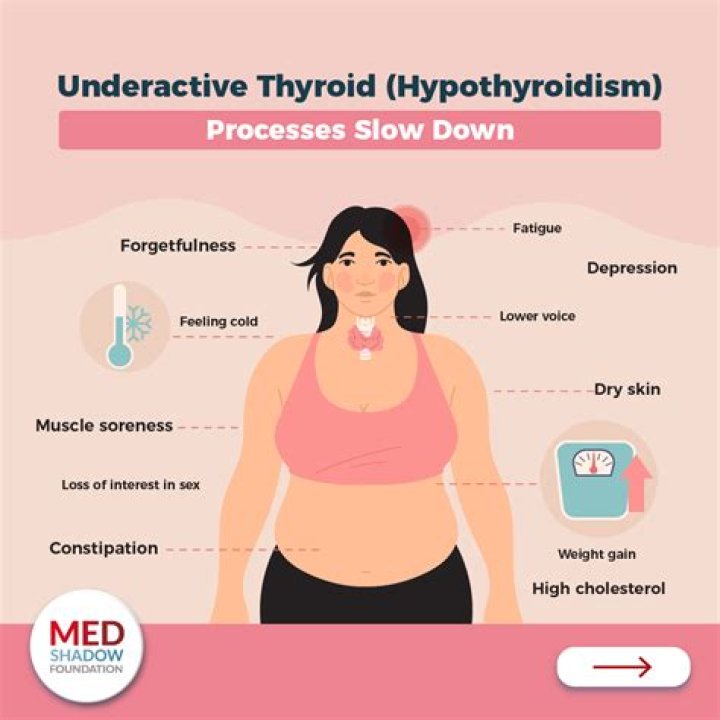 What does it mean when thyroid antibodies are high